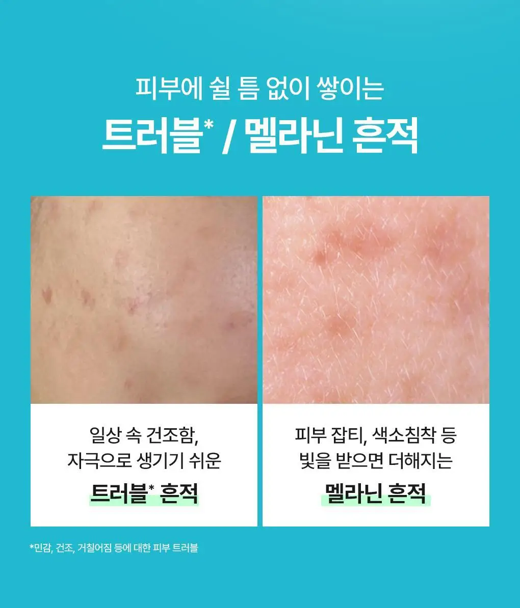 [초밀착 세럼팩/4매] 메디힐 랩핑 세럼 마스크 6종 상세페이지 10